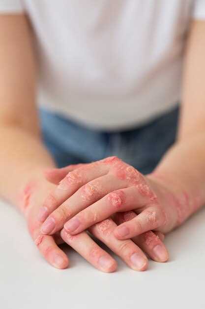 Аллергические реакции на контакт с кожей: варианты и способы лечения