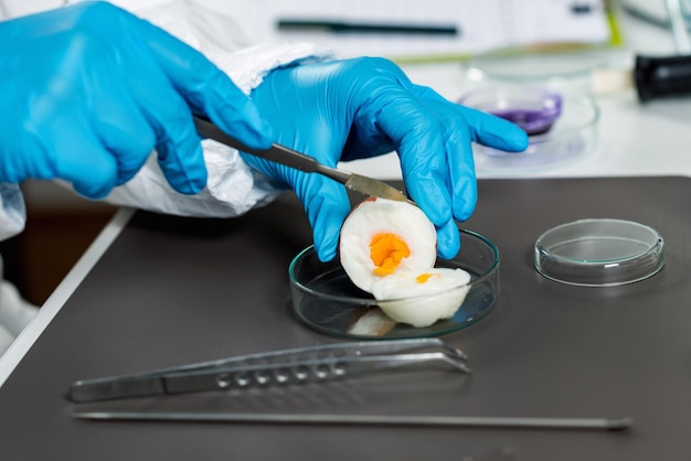 Анализ кала на яйца глист и простейшие