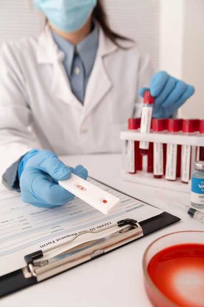 Как сдать и правильно интерпретировать общий анализ крови