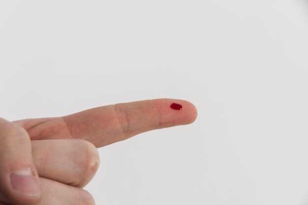Нужно ли сдавать кровь на ВИЧ сразу после контакта?