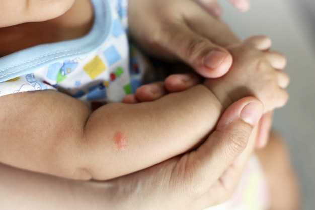 Причины облазит кожи на стопах у ребенка