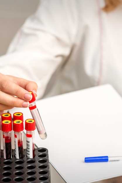 Показатель густой крови в анализе крови: значение и рекомендации