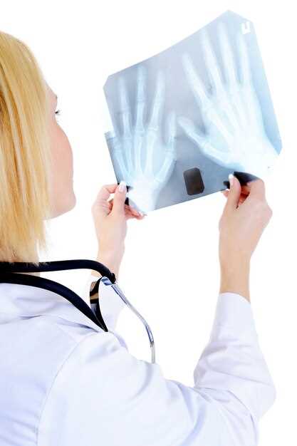 Рентгенография брюшной полости: особенности исследования и подготовки