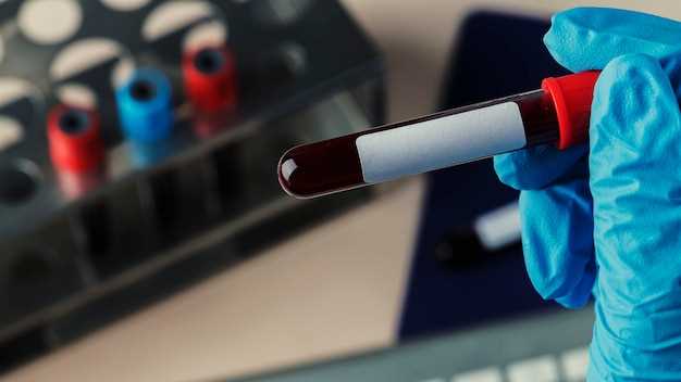 Сифилис: сроки и интерпретация результатов анализа крови