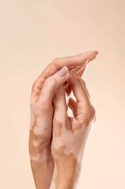Лечение вмятин на ногтях пальцев рук: проверенные методы