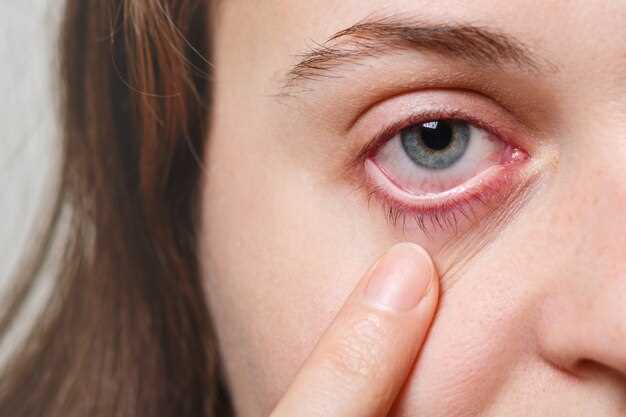 Причины воспаления глаз у человека